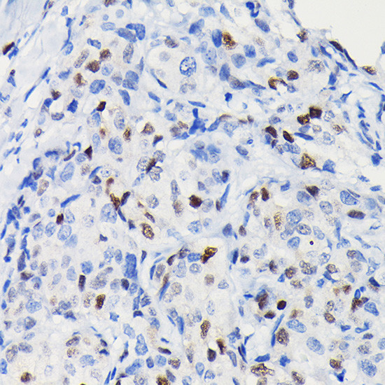 Cyclin D1 Antibody in Immunohistochemistry (Paraffin) (IHC (P))