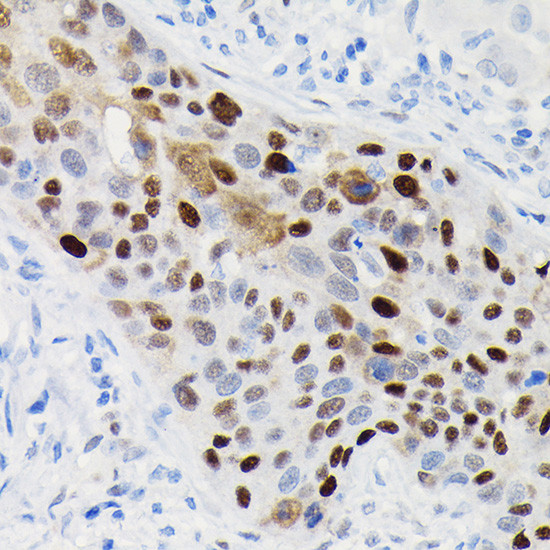 Cyclin D1 Antibody in Immunohistochemistry (Paraffin) (IHC (P))