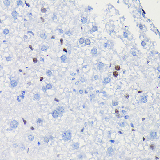 Cyclin D1 Antibody in Immunohistochemistry (Paraffin) (IHC (P))