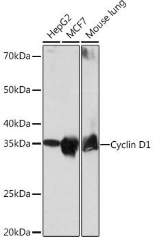 Cyclin D1 Antibody in Western Blot (WB)