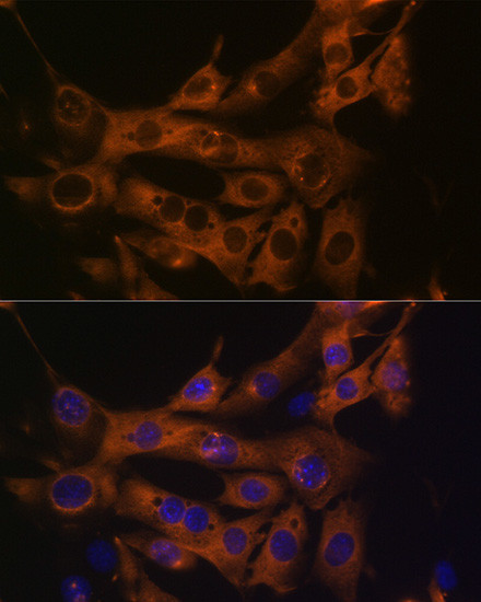 FASN Antibody in Immunocytochemistry (ICC/IF)