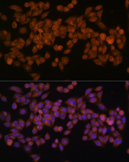 FASN Antibody in Immunocytochemistry (ICC/IF)