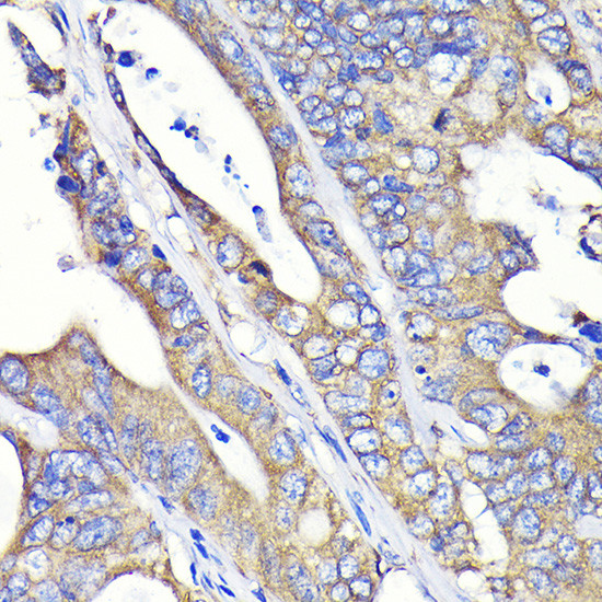 FASN Antibody in Immunohistochemistry (Paraffin) (IHC (P))