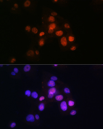 FOXA2 Antibody in Immunocytochemistry (ICC/IF)