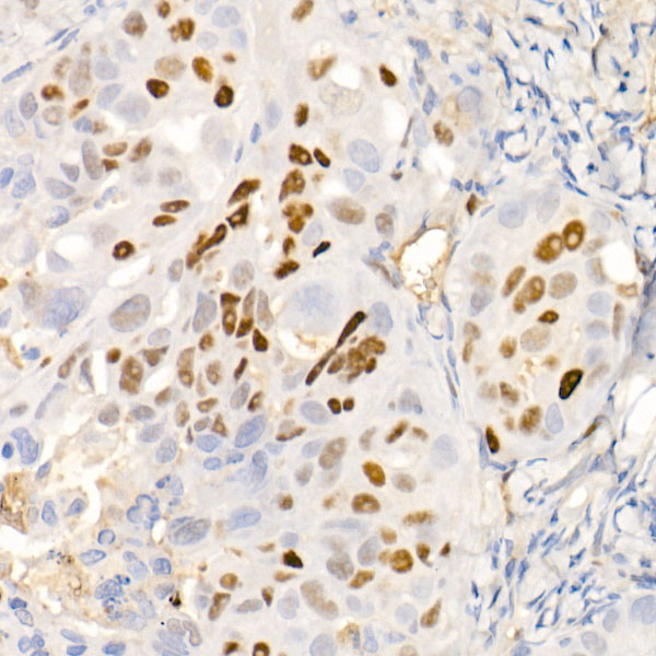 p21 Antibody in Immunohistochemistry (Paraffin) (IHC (P))