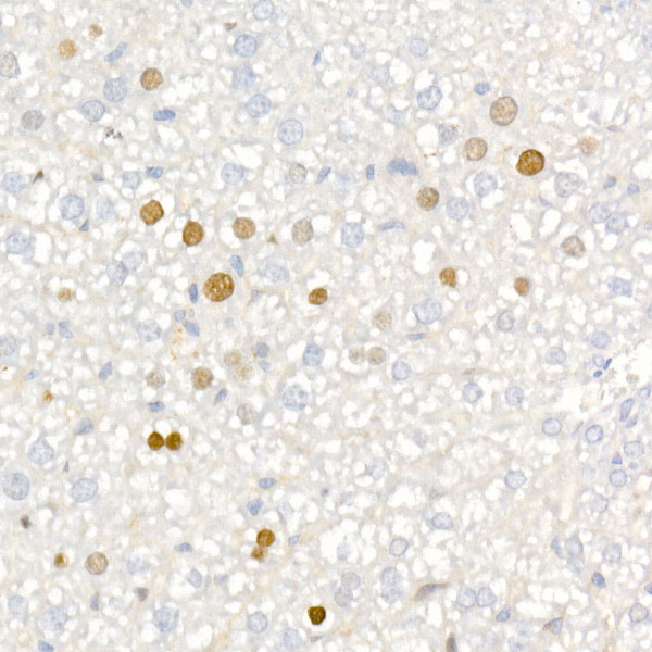 p21 Antibody in Immunohistochemistry (Paraffin) (IHC (P))