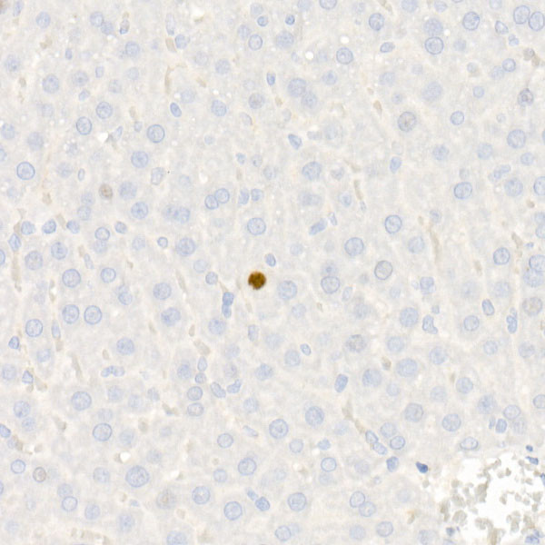 p21 Antibody in Immunohistochemistry (Paraffin) (IHC (P))