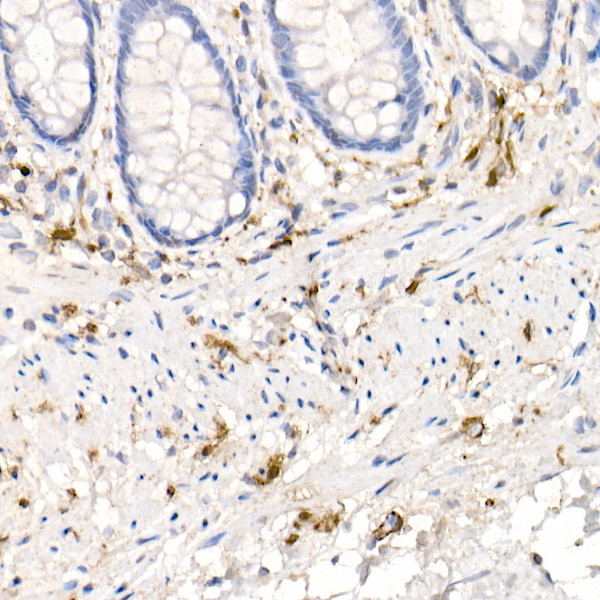 S100B Antibody in Immunohistochemistry (Paraffin) (IHC (P))