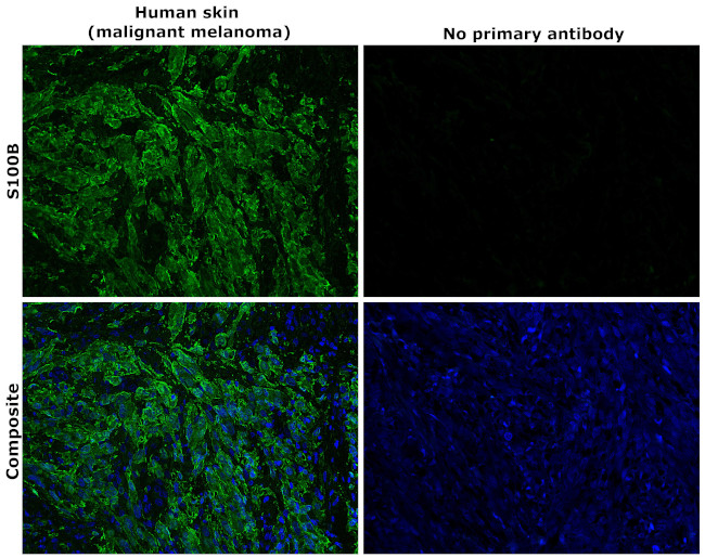 S100B Antibody in Immunohistochemistry (Paraffin) (IHC (P))