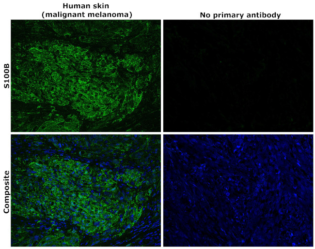 S100B Antibody in Immunohistochemistry (Paraffin) (IHC (P))