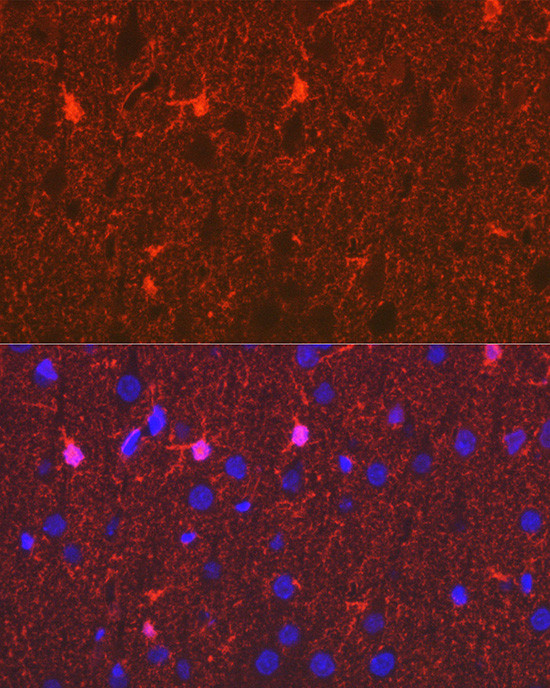 S100B Antibody in Immunohistochemistry (Paraffin) (IHC (P))