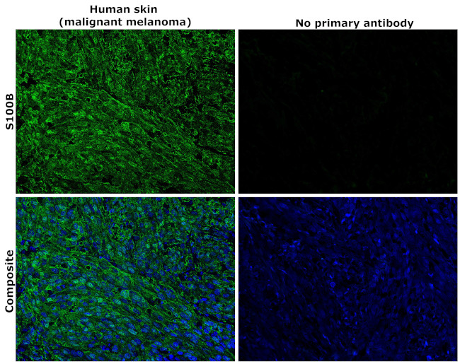 S100B Antibody in Immunohistochemistry (Paraffin) (IHC (P))