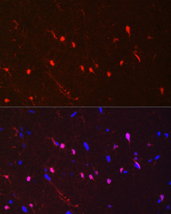 S100B Antibody in Immunohistochemistry (Paraffin) (IHC (P))