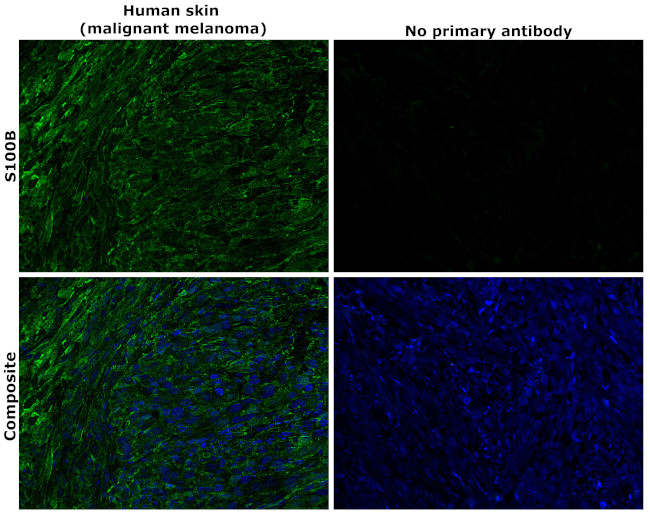 S100B Antibody in Immunohistochemistry (Paraffin) (IHC (P))