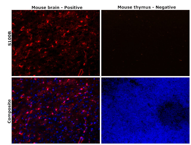 S100B Antibody in Immunohistochemistry (Paraffin) (IHC (P))