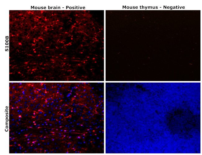 S100B Antibody in Immunohistochemistry (Paraffin) (IHC (P))