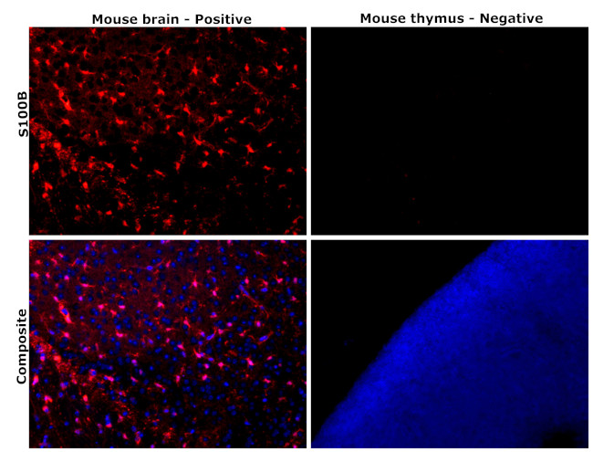 S100B Antibody in Immunohistochemistry (Paraffin) (IHC (P))