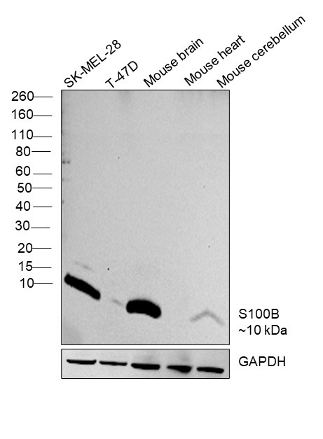 S100B Antibody in Western Blot (WB)