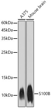 S100B Antibody in Western Blot (WB)