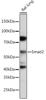 SMAD2 Antibody in Western Blot (WB)