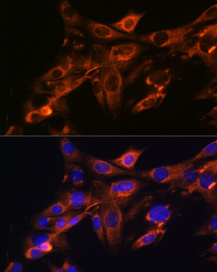 SRC Antibody in Immunocytochemistry (ICC/IF)