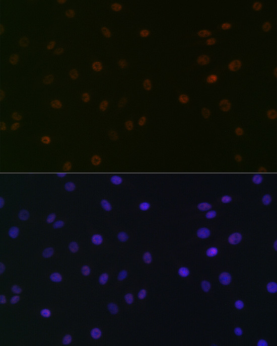 SPT5 Antibody in Immunocytochemistry (ICC/IF)