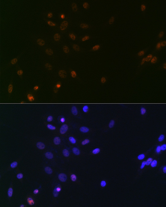 SPT5 Antibody in Immunocytochemistry (ICC/IF)