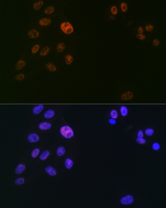 SPT5 Antibody in Immunocytochemistry (ICC/IF)