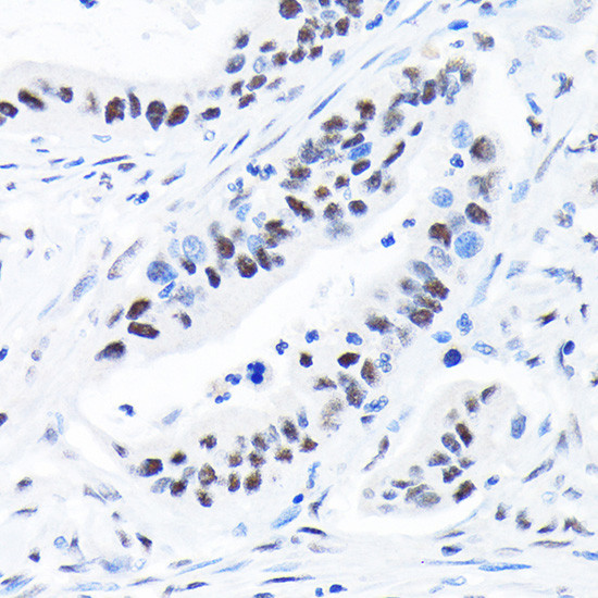 SPT5 Antibody in Immunohistochemistry (Paraffin) (IHC (P))