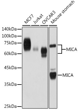 MICA Antibody in Western Blot (WB)