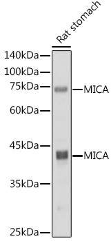 MICA Antibody in Western Blot (WB)