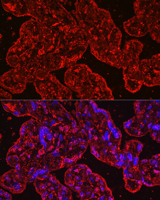 PROK1 Antibody in Immunocytochemistry (ICC/IF)