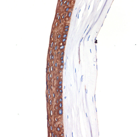 Cytokeratin 12 Antibody in Immunohistochemistry (Paraffin) (IHC (P))