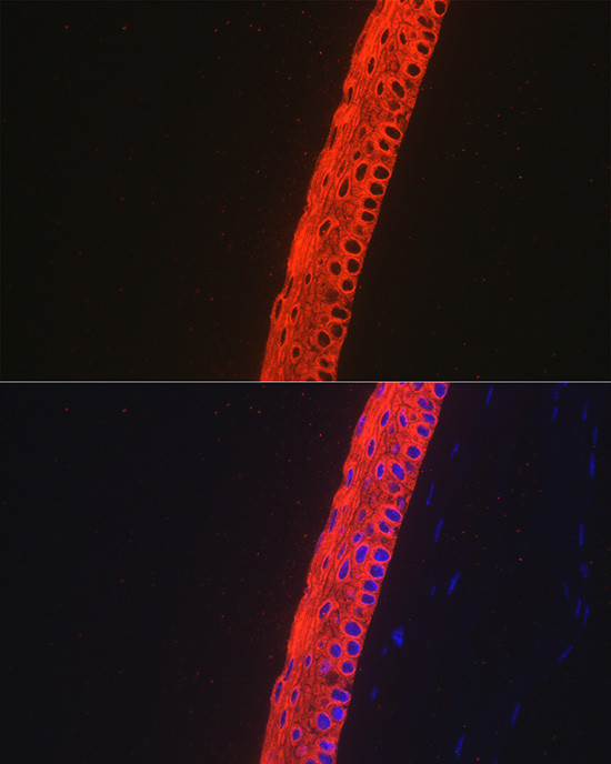 Cytokeratin 12 Antibody in Immunohistochemistry (Paraffin) (IHC (P))