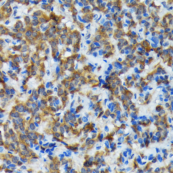 Thyroid Peroxidase Antibody in Immunohistochemistry (Paraffin) (IHC (P))