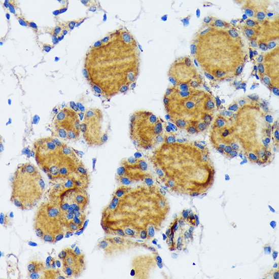 Thyroid Peroxidase Antibody in Immunohistochemistry (Paraffin) (IHC (P))