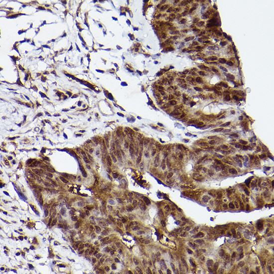 ERK1 Antibody in Immunohistochemistry (Paraffin) (IHC (P))