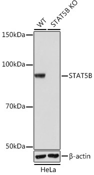 STAT5 beta Antibody in Western Blot (WB)