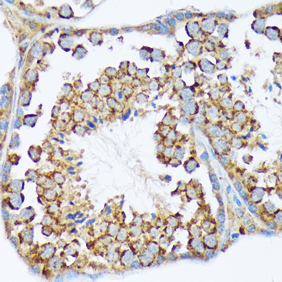 WAVE2 Antibody in Immunohistochemistry (Paraffin) (IHC (P))