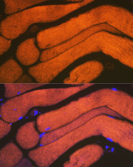 alpha Actinin 3 Antibody in Immunocytochemistry (ICC/IF)