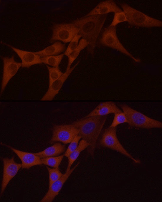 NFkB p65 Antibody in Immunocytochemistry (ICC/IF)