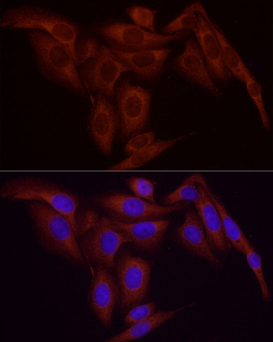 NFkB p65 Antibody in Immunocytochemistry (ICC/IF)