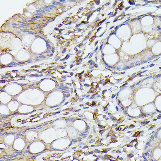 NFkB p65 Antibody in Immunohistochemistry (Paraffin) (IHC (P))