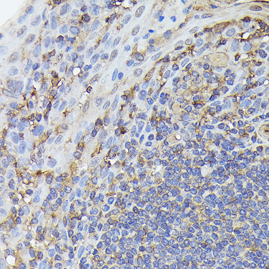 NFkB p65 Antibody in Immunohistochemistry (Paraffin) (IHC (P))