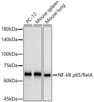 NFkB p65 Antibody in Western Blot (WB)