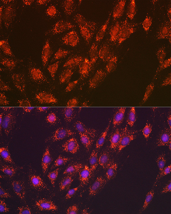 Versican Antibody in Immunocytochemistry (ICC/IF)