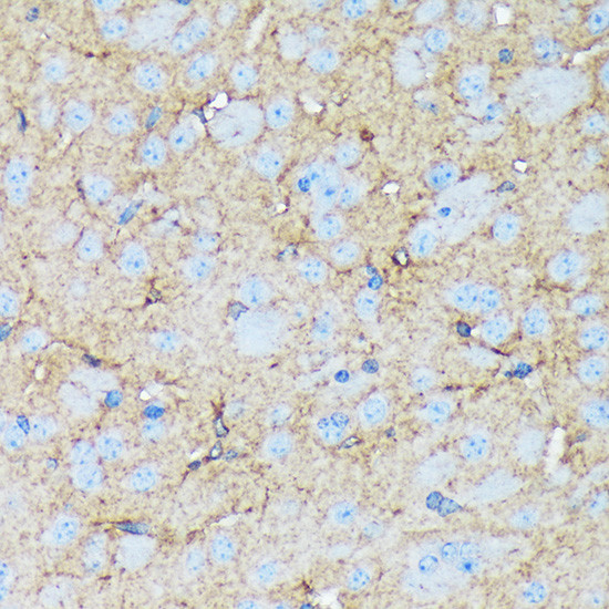 Versican Antibody in Immunohistochemistry (Paraffin) (IHC (P))