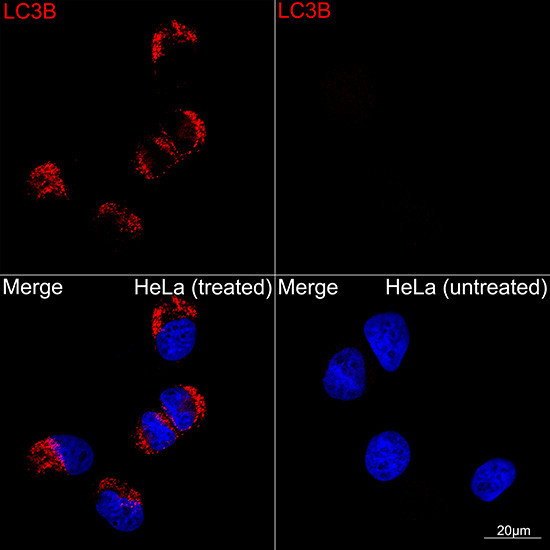 LC3B Antibody in Immunocytochemistry (ICC/IF)