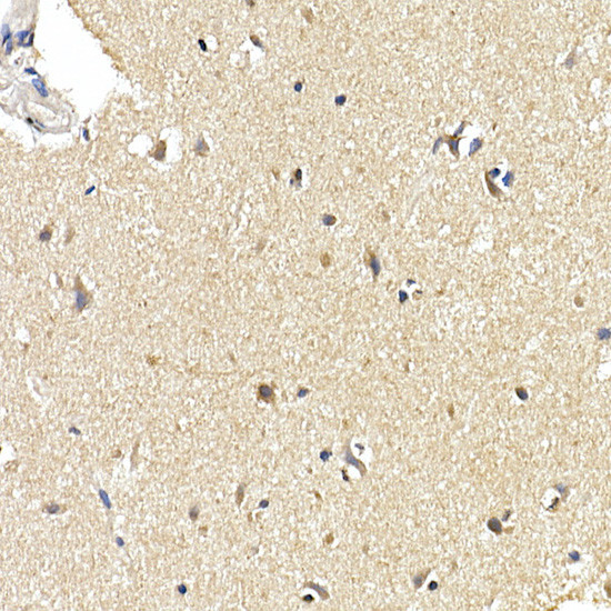 LC3B Antibody in Immunohistochemistry (Paraffin) (IHC (P))