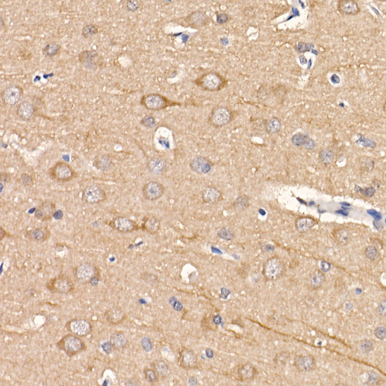 LC3B Antibody in Immunohistochemistry (Paraffin) (IHC (P))